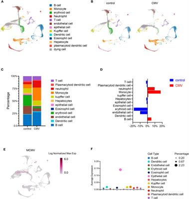 Acute murine cytomegalovirus infection boosts cell-type specific response and lipid metabolism changes in the liver of infant mice